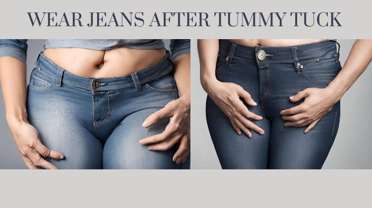 when can i wear jeans after tummy tuck