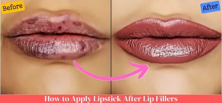 How to Apply Lipstick After Lip Fillers